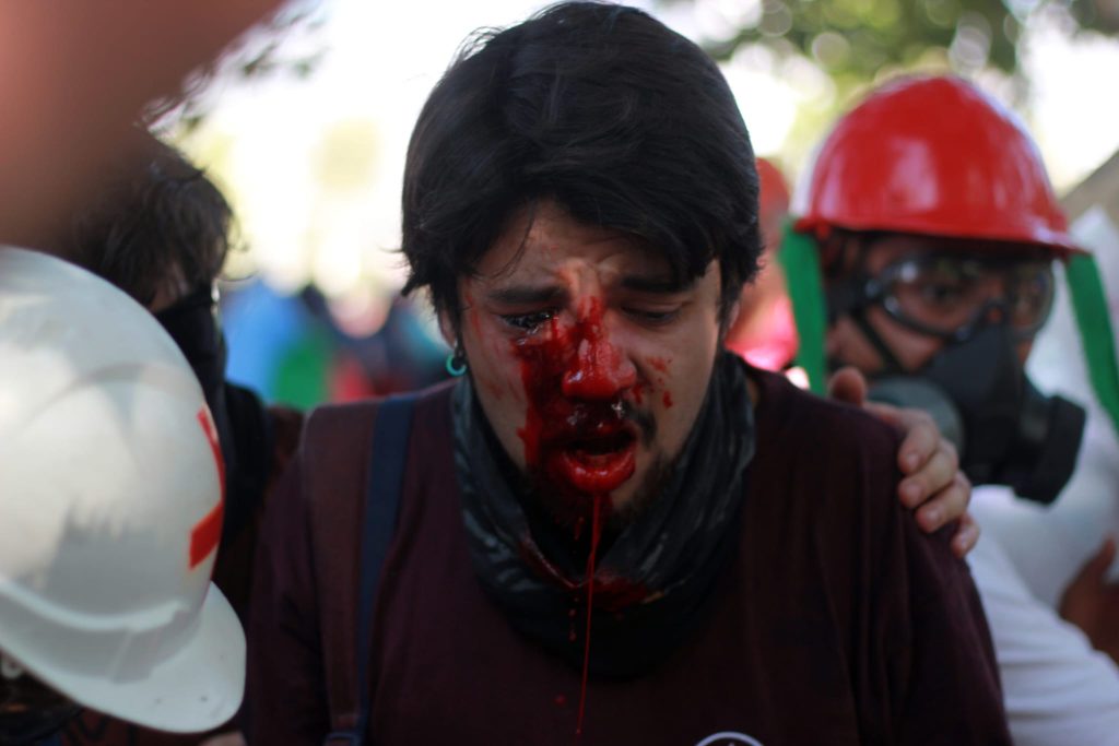 La memoria de Diego Leppez, a casi siete años de perder un ojo por el disparo de una lacrimógena de Carabineros 3 WhatsApp Image 2026 07 23 at 20.15.16 1