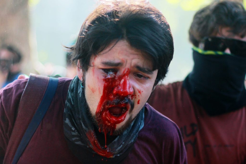 La memoria de Diego Leppez, a casi siete años de perder un ojo por el disparo de una lacrimógena de Carabineros 2 WhatsApp Image 2026 07 23 at 20.15.16